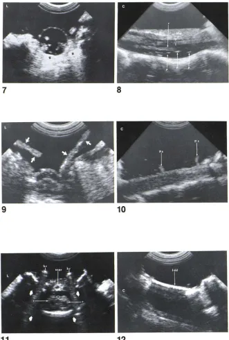 Fig= ization this material can materesult no significant sonographic information dura (fdd) was used for treatment of Chiari I malformation, freeze-driposterior C 