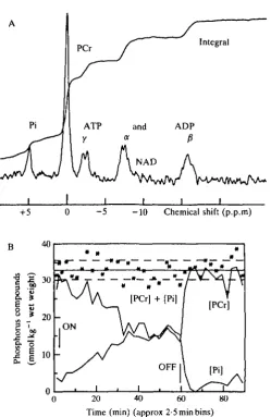 Fig. 8. (A) 31forearm muscle using a surface<coil in the 20-cm TMR 32 spectrometer at Oxford Research Systemson Oct