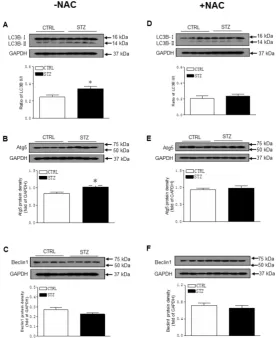 Figure 6. Effect of GDM on autophagy-related protein expression in male offspring. The hearts were isolated from both control (□) and STZ-treated (■) groups of male offspring