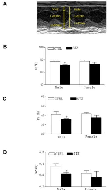 Figure 2. Effect of GDM exposure on ischemia-induced myocardial infarction in offspring