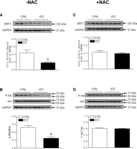 Figure 5. Effect of GDM on the protein expression of Sirt1 and p-Akt/Akt in male 