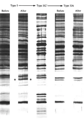 Fig. 1. One-dimensional SDS polyacrylamide gel electrophoresis (Baumann, Cao & Howald, 1984)of type I and type IIA muscle fibres before and after (A) strength or (B) endurance training