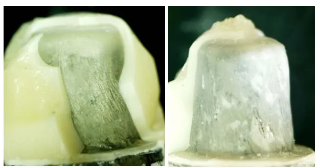 Fig. 2:  External surface of a fractured specimen with a standard core (SC) design at ×10 magnification 