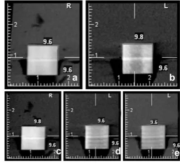 Fig. 1: (a,b) the phantom used in this study; (c) digital caliper  