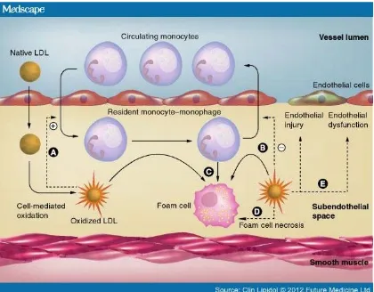 Figure 2.1. Development of atherosclerosis by oxLDL filtration. 