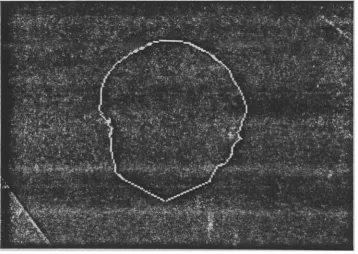 Fig. 6e. The Result of Thinning the Image in Figure (6b)