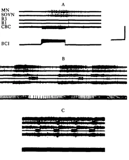 Fig. 4. BCI class I-A cell elicits activity in brain roots (A) when depolarized and is active during (B)the primary and (C) the vomiting motor patterns evoked by MGON stimulation