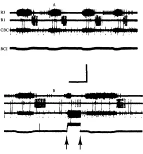 Fig. 6. BCI class II cell affects buccal motor output. (A) During the primary pattern this BCIreceives inhibitory synaptic input in-phase with R3 activity
