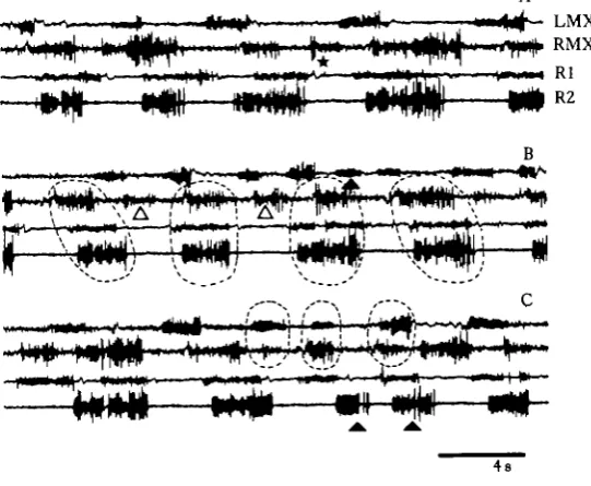 Fig. 3. (A-C) Examples of rhythm perturbation in Scyllarus (explanations in text). Calibration :4 a.