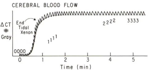 Fig. 16.-Xenon formula and summary CT, protocol for data acquisition. Basic autoradiographic of acquisition of data points