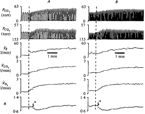 Fig. 1. VentiJatory and pulmonary gas exchange responses to 125 watts cycle ergometerexercise beginning either from restNote that a large, abrupt hyperpnoea at exercise onset is evident from prior rest but not fromprior mild exercise, and that in neither c