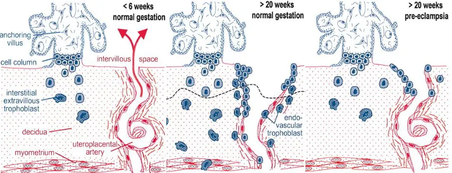 Figure 1.4: Schematic representation of EVT invasion and artery remodeling during normal and preeclamptic pregnancy (modified from Kaufman et al.)30