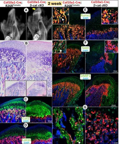 Figure 2. Deletion of βof cKO subchondral bone in cKO mice, with a sharp reduction in expression of Runx2 -catenin in HCs resulted in diminished endochondral bone formation