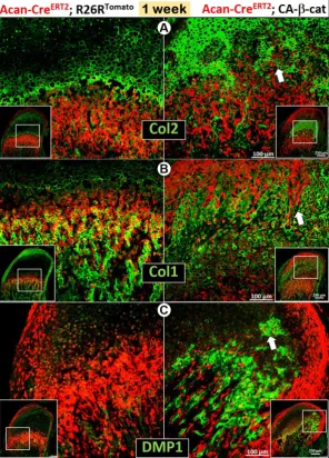 Figure 3. Constitutive activation of βCA-trans-differentiation of chondrocytes into red bone cells in the cartilage region of CA--catenin in MCC accelerated chondrogenesis and osteogenesis in early postnatal development