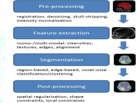 Figure 2. Illustration of the main blocks used     for building up the segmentation pipeline of most algorithms included in this review