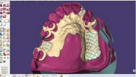 Fig. 2: Immersive virtual reality; head mounted displays (HMD) and data gloves  