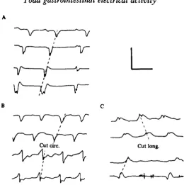 Fig. 5. Effects of low sodium solution (15 mM) on toad slow-spikes as recorded by pressureelectrodes