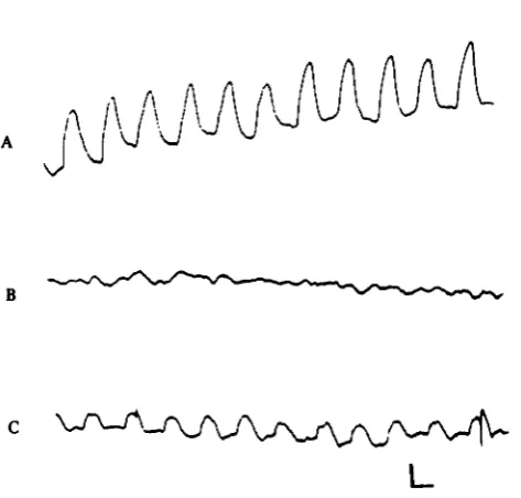 Fig. 9. Effects of low sodium solution on toad intestinal slow-waves as recorded with pressureelectrodes