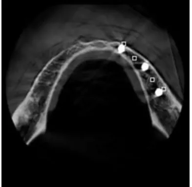 Fig. 3: (a) Sagittal, (b) axial and (c) panoramic images.