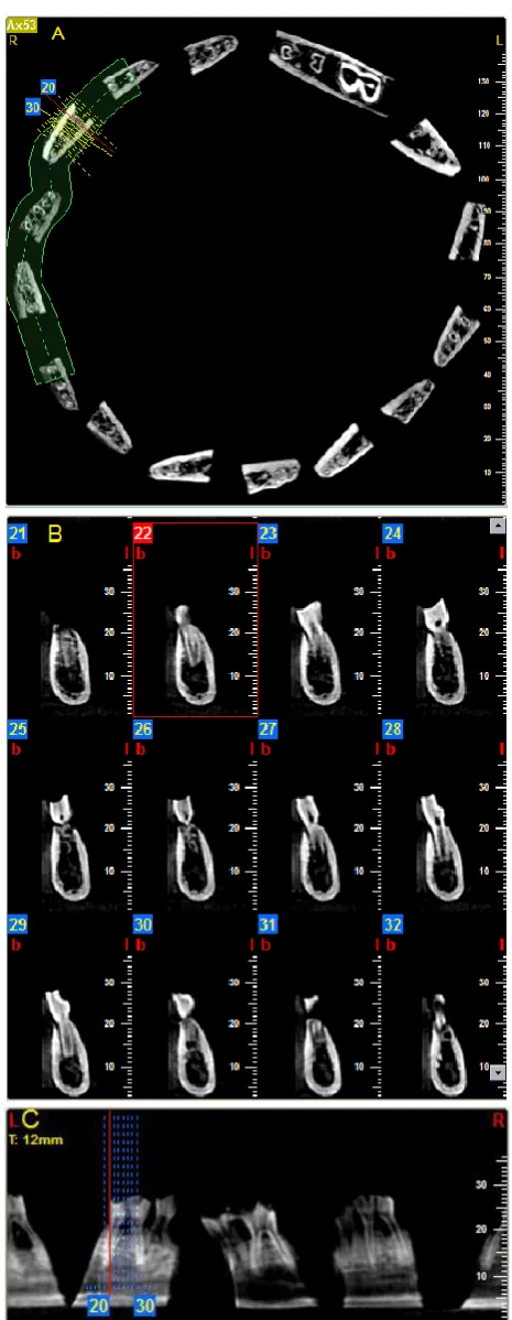 Fig. 2: (A) Axial section; (B) cross section and (C) sagittal section of blocks containing teeth