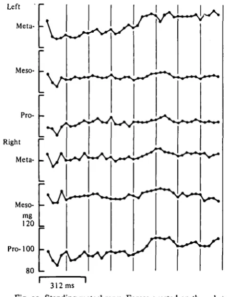 Fig. 11. Changes in the force exerted on the substrate by one mesothoracic leg when the�increased, an upward deflexion means the force on the substrate decreased