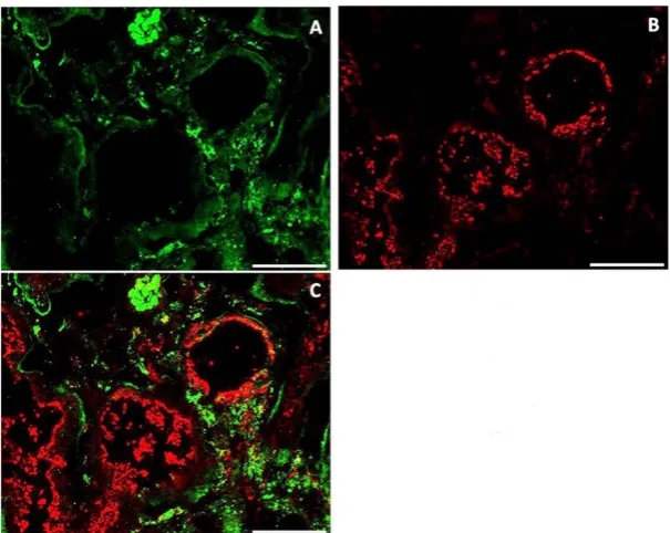 Figure 11. IS of Fetuin (A), FGF23 (B) and merge (C) in human kidney tissue. Scale bars: 50μm