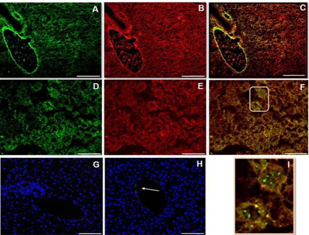 Figure 1. IS (immunostaining) of Fetuin-A (A, D), FGF23 (B, E) and MERGE (C, F) visualized respectively by Fitc presence