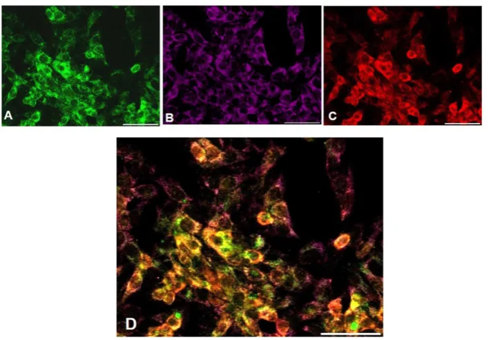 Figure 2. Fetuin-A (A, D), FGF23 (B, E) and merge (C, F) expression visualized respectively by Fitc and rhodamine IS in primary hepatocytes and in HepG2