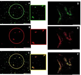 Figure 9. Fetuin-A (A), FGF23 (B) and merge (C) IS in the periportal vein interstice (human liver)