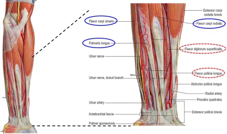 Figure 2.1. Superficial flexor muscles of the left forearm. 