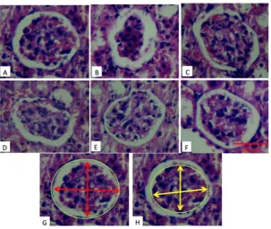 Table 2 presents histopathological changes in the renal tissues of mice in different groups