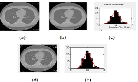 Figure 3: The image after watershed segmentation. 