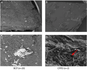 Figure 3Electron microscope analysis of cartilage mineralizationa subset of 20 consecutive specimens out of the total 80