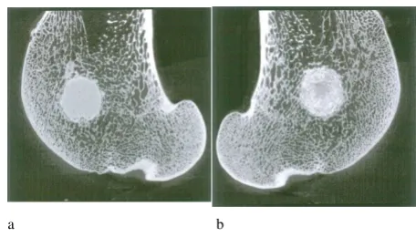 Figure 3and (b) OstimOstimDefects centralized, confined (a) Alpha-BSMDefects centralized, confined (a) Alpha-BSM® and (b) ®
