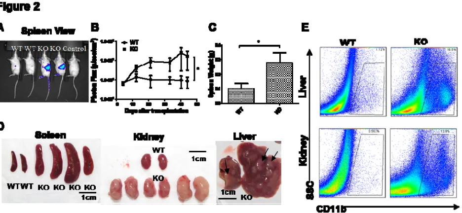 Figure 2. Myeloid sarcoma is transplantable into immunocompromised Rag2-/- (E)and livers