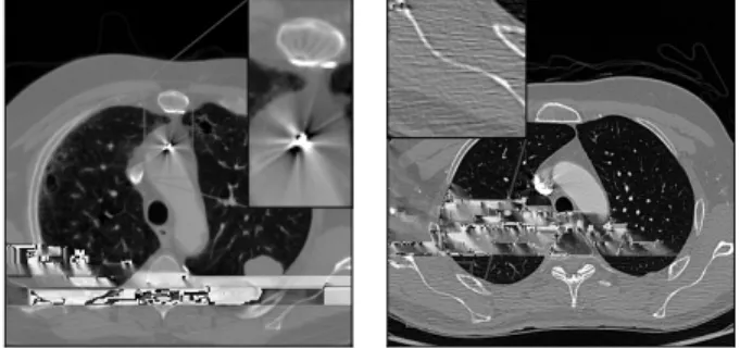 Figure 1. Ground truth samples from the LoDoPaB-CT dataset containing artifacts. These errors stem from the reconstruction technique that was used on the normal-dose measurements.