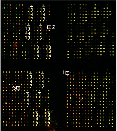 Figure 1. Normalization is an integral part in cDNA microarray dataprocessing for differential gene expression