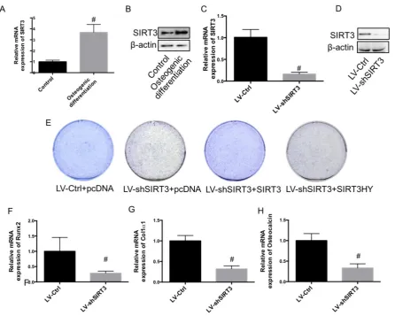 Fig. 1 Effect of knockdown of SIRT3 on osteogenic differentiation. MC3T3-E1 cells were induced to osteogenic differentiation, and SIRT3 expression was determined in pre-osteogenic MC3T3-E1 cells and differentiated MC3T3-E1 cells using real-time PCR (A) and