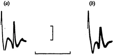 Fig. 1. Recordings from nerve zin anerves were intact (6) Five superimposed flexor patterns recorded after all the antennular(large spike) and A32F during patterns of activity which, in an intact antennule, always resultnerves have been cut distal to the r