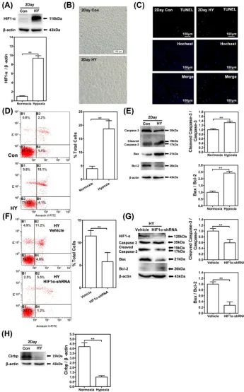 Figure 2. Chronic hypobaric hypoxia exposure could induce cell apoptosis and significant decreased CIRBP expression in SH-SY5Y cells