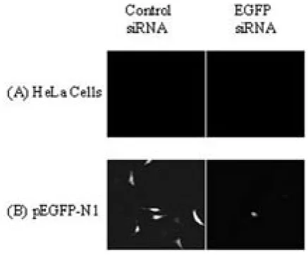 Figure 2. Epifluorescence microscope at 20X magnification in HeLa cells 72 hours following co-transfection with small interfering RNAs (siRNAs)