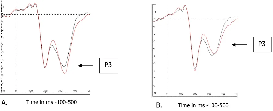 Figure 7  ERPs obtained on electrode Fcz are presented for the CC sequences (black) and IC 