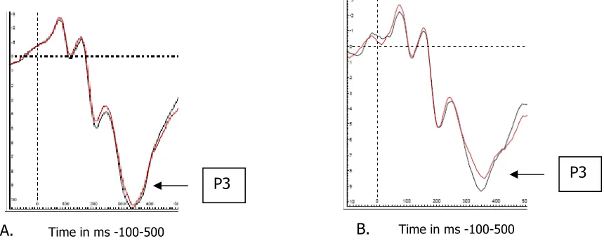 Figure 8  ERPs obtained on electrode Pz are presented for the CC sequences (black) and IC 