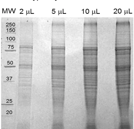 Figure 1.3 - An example of a 1D SDS-PAGE gel stained with Coomassie blue 