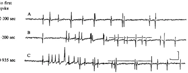 Fig. 2. Optic nerve responses to illumination at different intensities. Stimuli were 1terminated prior to the illustrated segment
