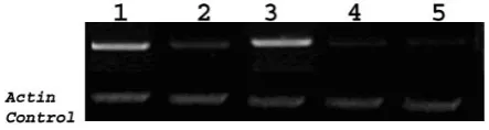 Fig. 1. A Construction of binary vector pBin438 harboring the AS-cDNA of OsARF1 in the antisense orientation driven by 35S promoter and Nosterminator