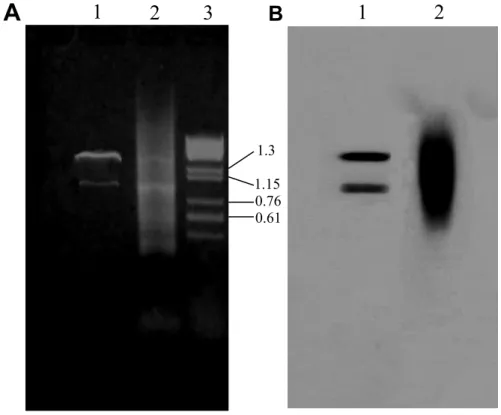 Figure 3. Comparative demonstration of the PCR products obtained applying the magnetic capture hybrid selection technique  (lane 1) and 3΄ RACE (lane 2)