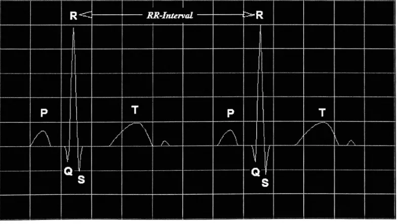 Figure 2.4: Cardiac Signal, Illustrating the RR Interval.