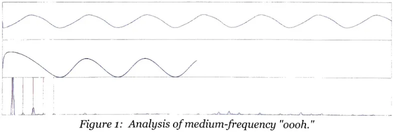 Figure 1: Analysis ofmedium-frequency