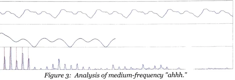 Figure 3: Analysis ofmedium-frequency